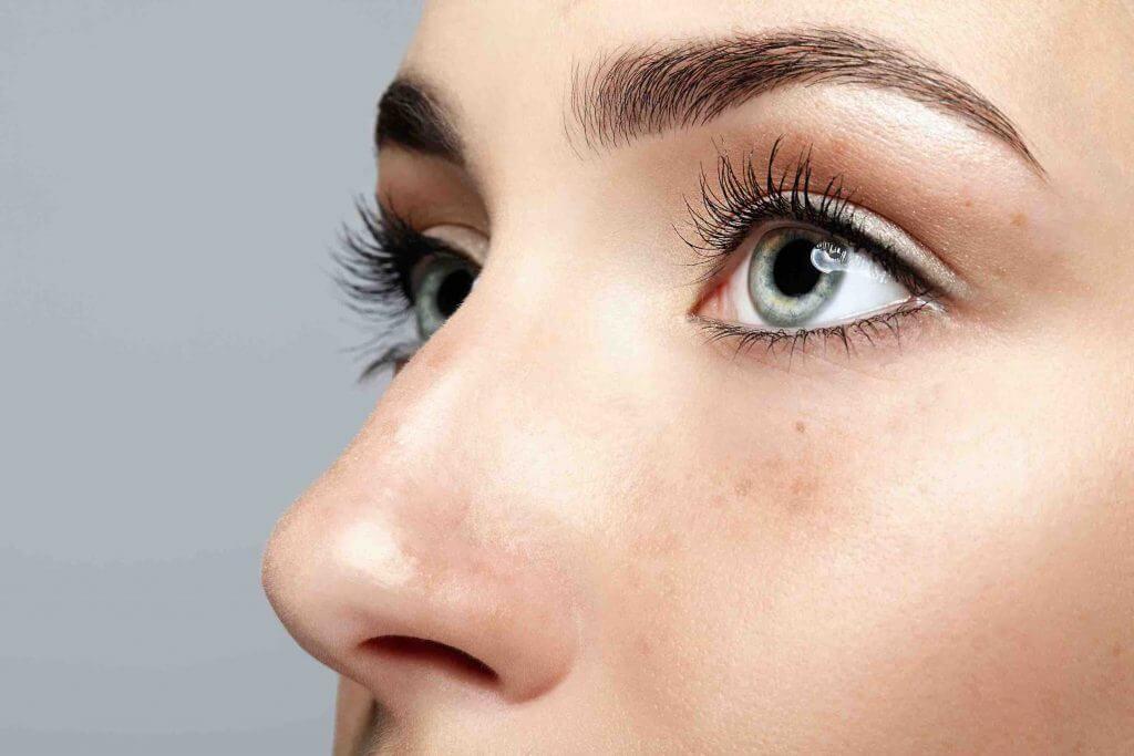 Rinoplastia